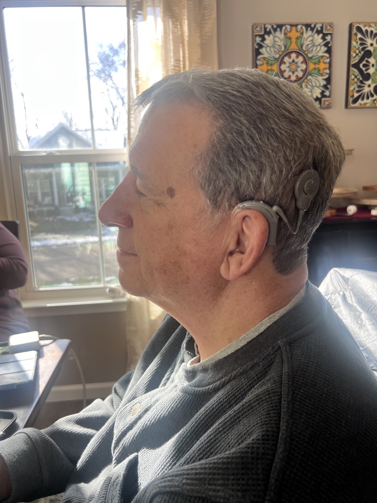 Steve in profile, the cochlear implant processor visible behind his ear